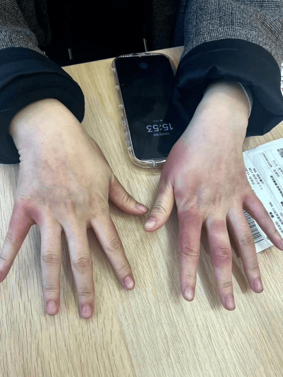 皇冠登录网址_东北姑娘来浙江后崩溃了皇冠登录网址，穿3条加绒裤还冻到发抖！南方人冬天怎么保命，网友吵翻！